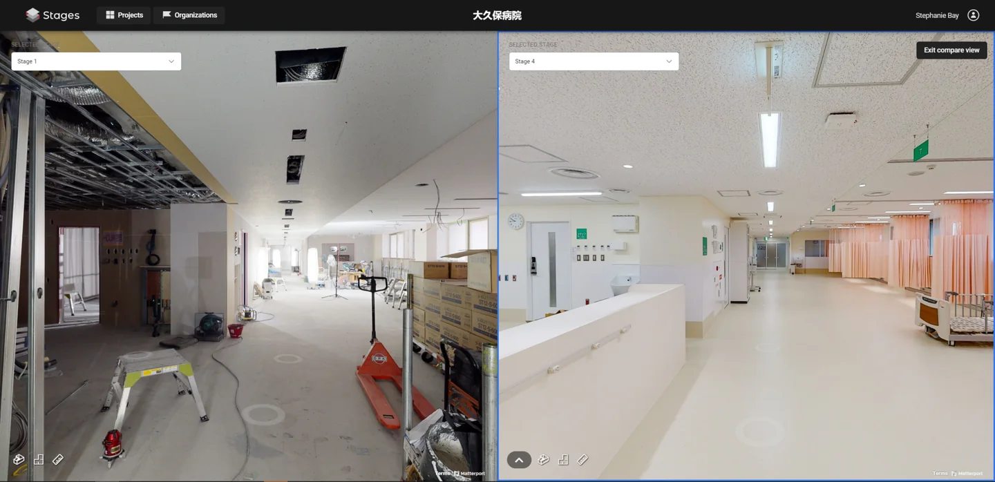 STAGES compare view of Okubo Hospital: corridor under renovation with an open ceiling and tools (Stage 1) beside the finished ward corridor (Stage 4)